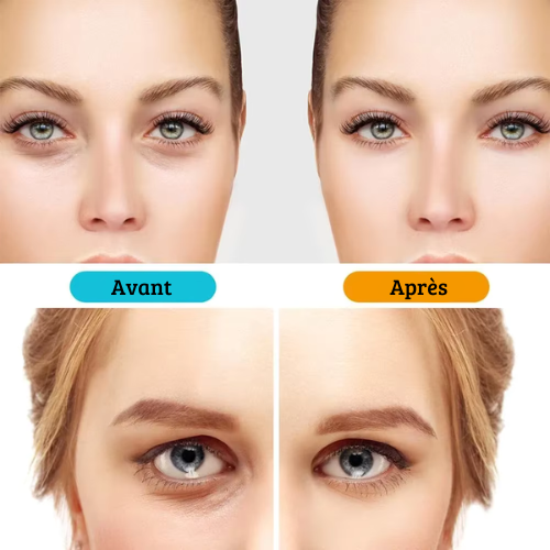 Lunette pour Cernes sous les Yeux